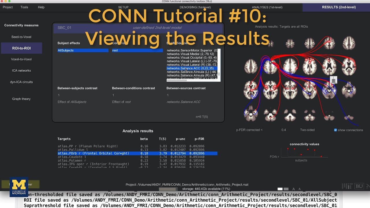 CONN Tutorial #10: Viewing the Results