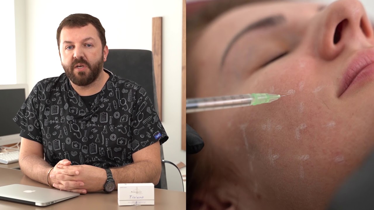 Tiziano Mezoterapi Uygulaması