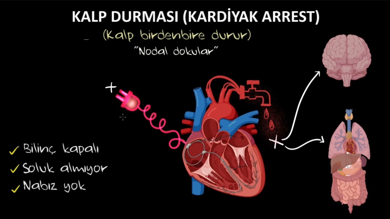 Kalp Durması (Kardiyak Arrest) (Sağlık Bilgisi ve Tıp)