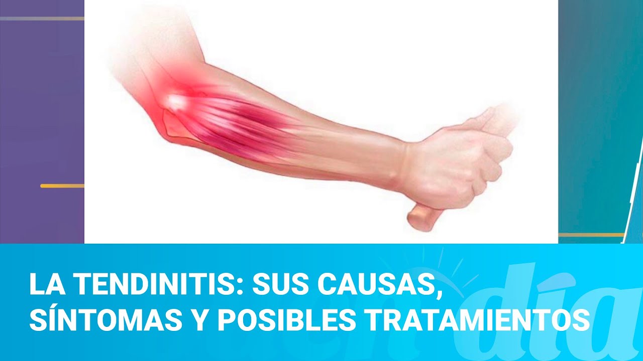 La tendinitis: Sus causas, síntomas y posibles tratamientos