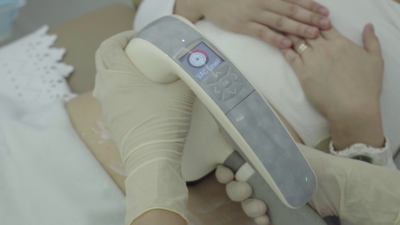 Velashape III – Latest technology for body reshaping