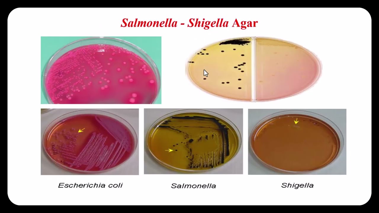 Enterobacteriaceae
