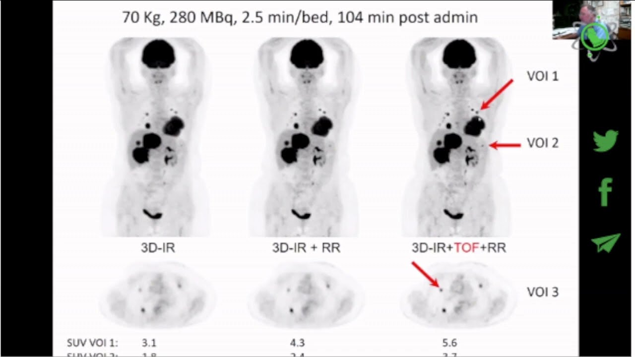 Recent Advances in PET/CT imaging