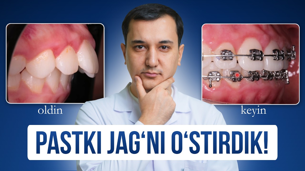 Jag‘ nega o'sishdan orqada qoladi va uni qanday oldinga chiqarish mumkin? | Keys tahlili