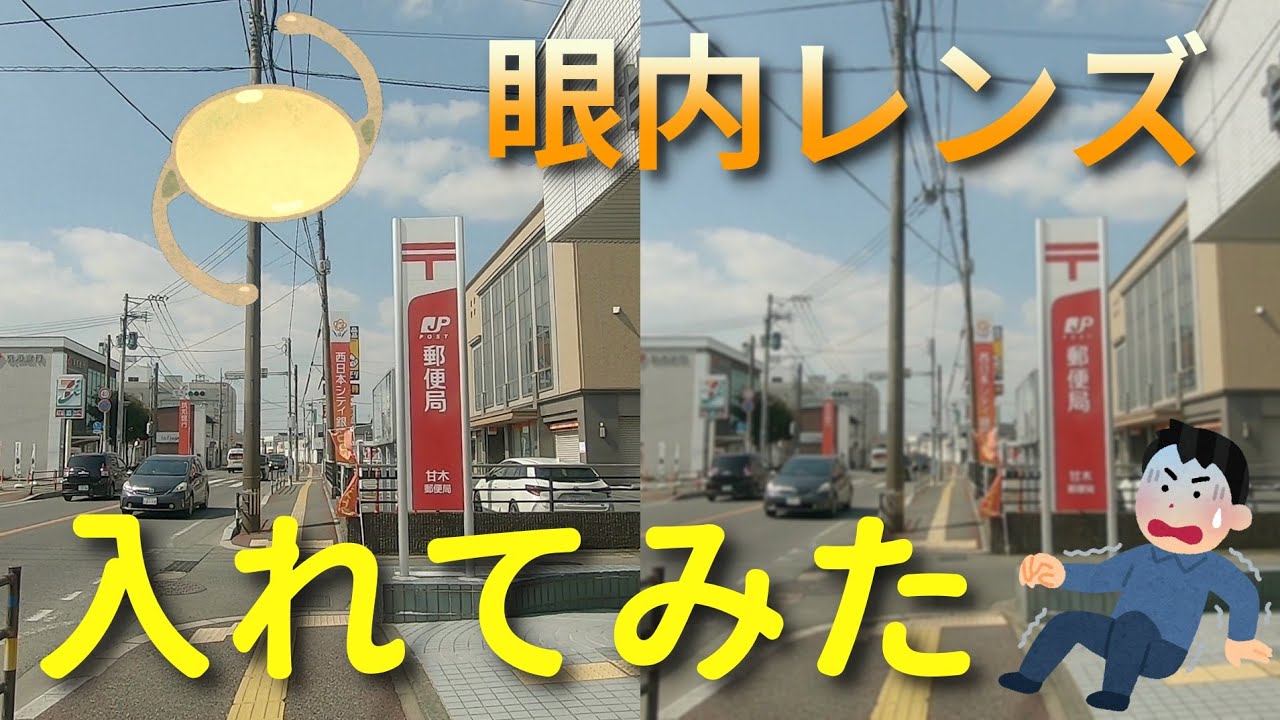 [白内障手術体験談]単焦点眼内レンズ、こういう感じに見えています。 250316