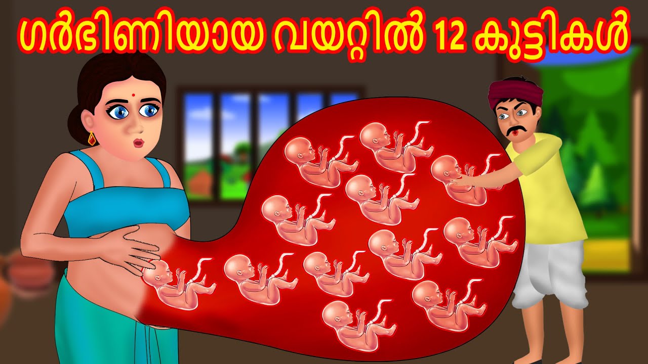 ഗർഭിണിയായ വയറ്റിൽ 12 കുട്ടികൾ | Malayalam Story | Cartoon Malayalam | Malayalam Katha