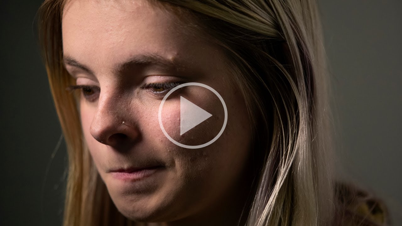 How foster care placements can harm a child's brain