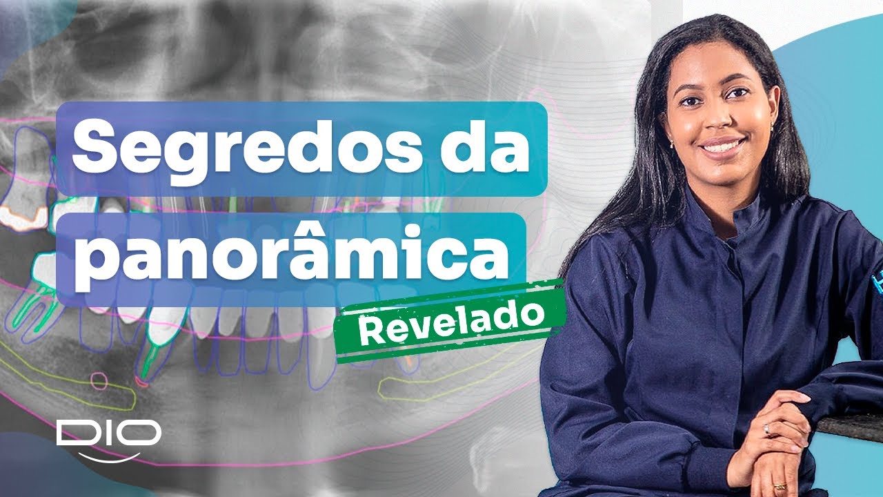 Posicionamento da Radiografia Panorâmica Odontológica | MASTERCLASS Radiologia - DIO | Dra. Juliana
