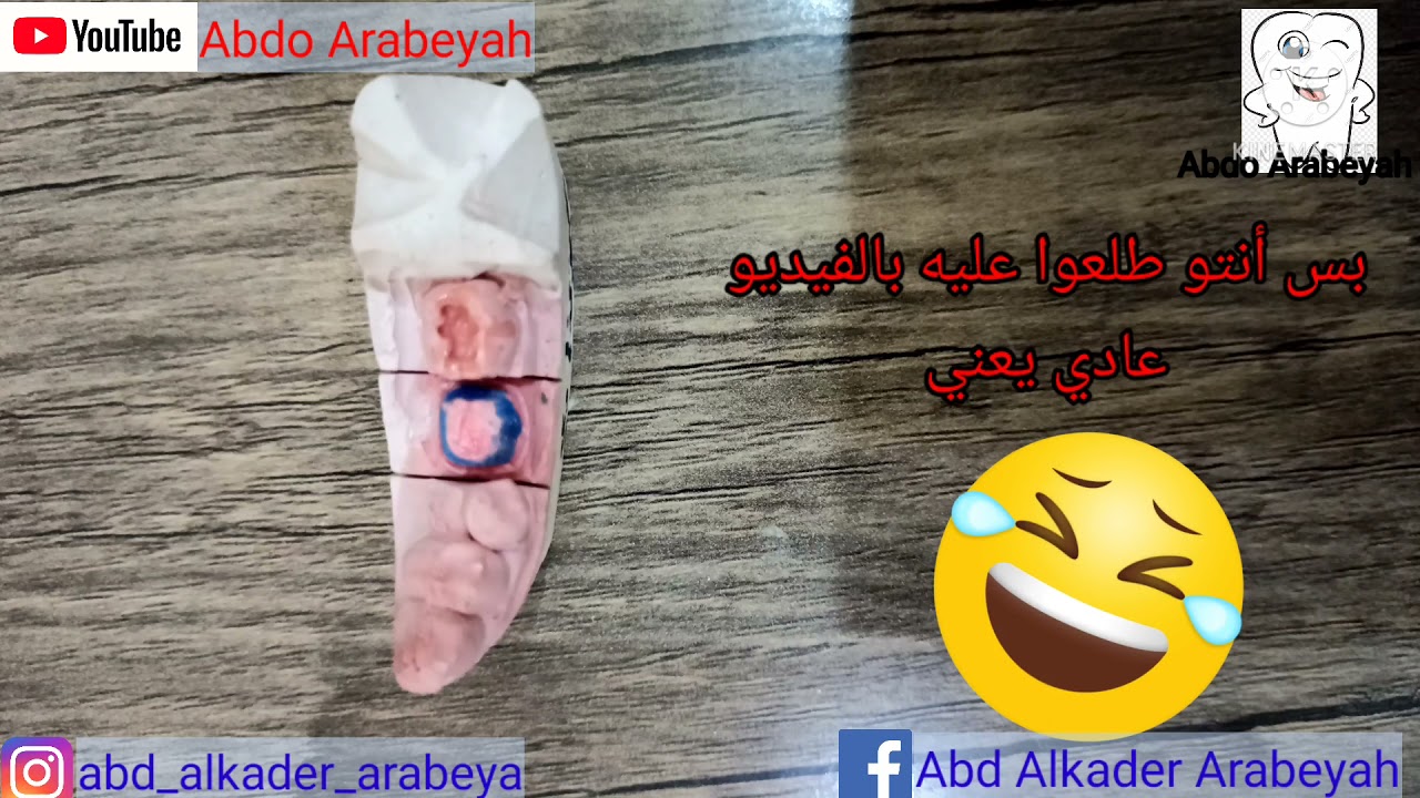 طريقة حفر الضرس و عمل حشوة له بالتفصيل العملي Tooth cavity preparation