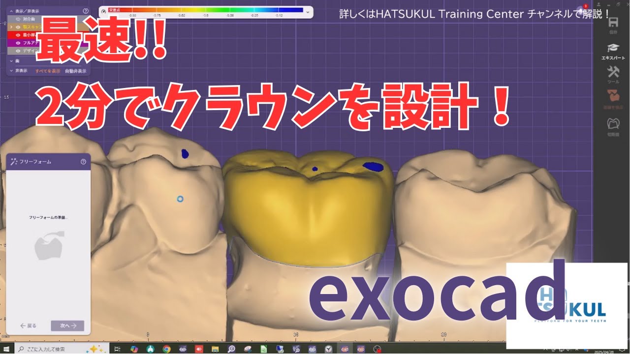 #036　exocad設計　最速設計！2分でクラウン！（解説ナシ版）