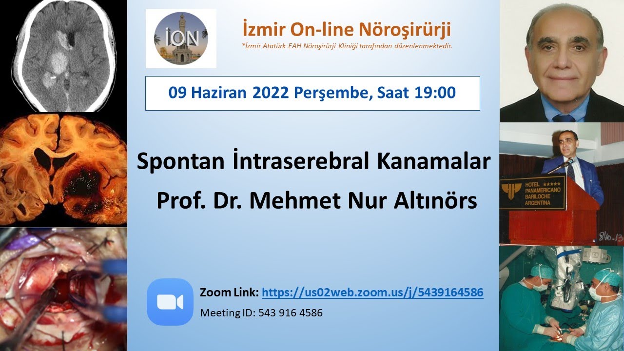 ION 247. ZOOM lecture, Altınörs: İntraserebral kanamalar, 09.06.22