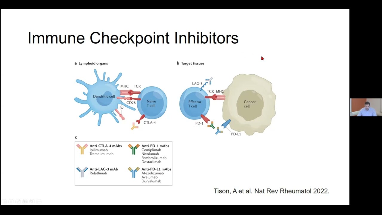 June 17, 2025 MUHC MGR by Dr. Nader Toban, Assistant Professor, Division of Rheumatology