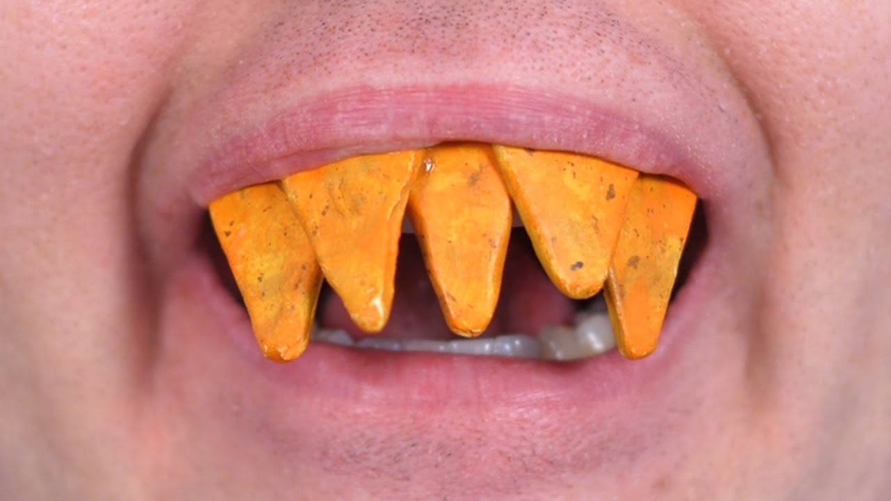 Teeth Made of Doritos!