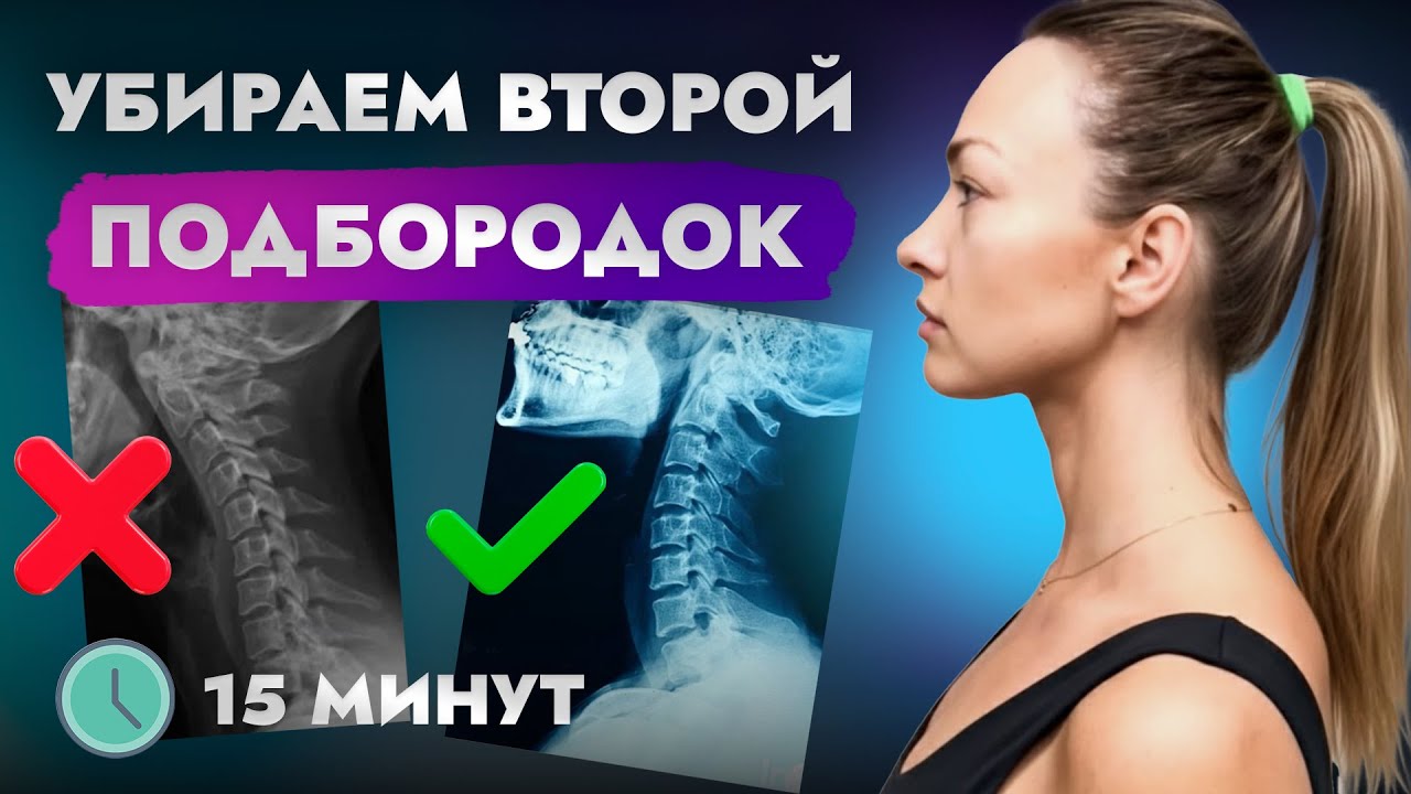 Как убрать второй подбородок, если челюсть уехала назад! 15 минут