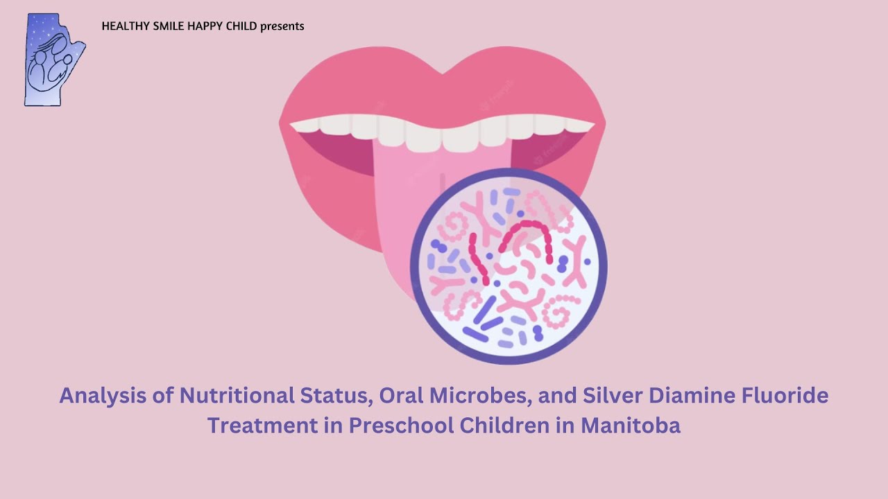 Nutritional Status, Oral Microbes, and Silver Diamine Fluoride Treatment in Oral Health