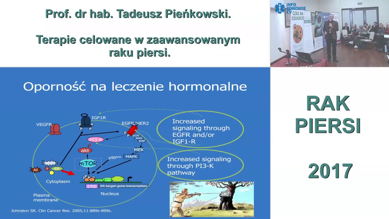 Terapie celowane w zaawansowanym raku piersi