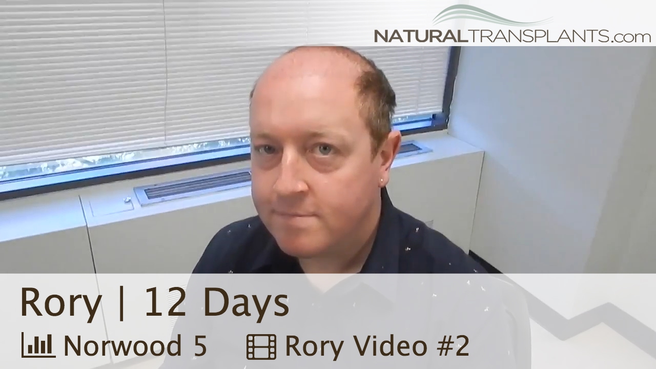 Hair Transplant Surgery | 12 Day Followup (Rory)