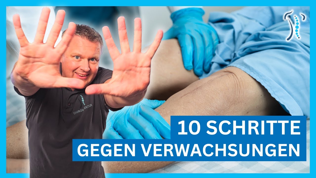 10 Schritte gegen Narbenverwachsungen - Effektive Vorbeugung und Behandlung