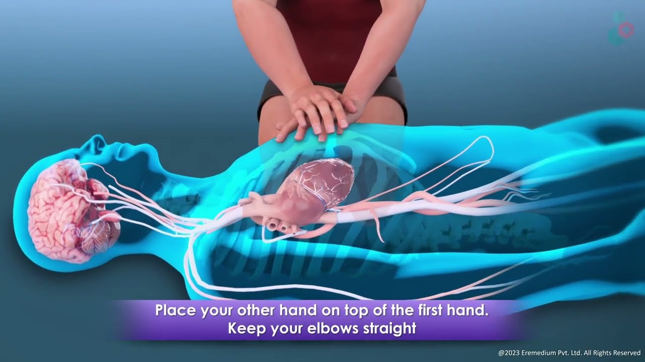 How to Perform CPR: Hands-Only and Mouth-to-Mouth | 3D Guide