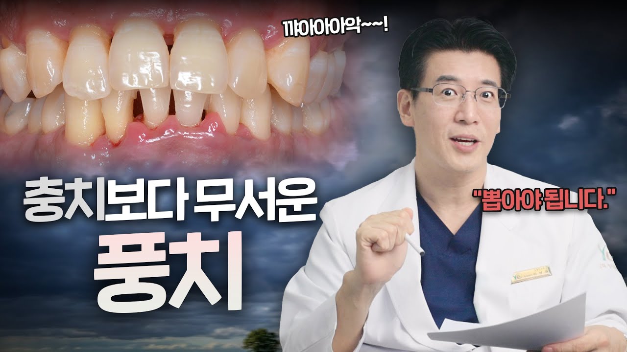 풍치 답도 없습니다. 충치보다 치명적인데 사람들이 잘 몰라요 🥲