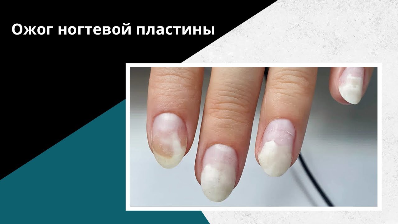 ОЖОГ ногтевой пластины! Почему НЕЛЬЗЯ терпеть если ПЕЧЁТ в лампе?