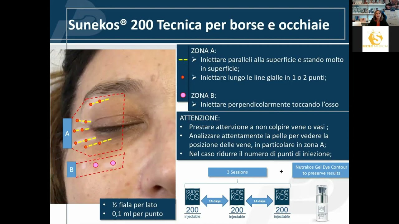 Spiegazione rapida di come utilizzare Sunekos nel perioculare per trattare borse e occhiaie
