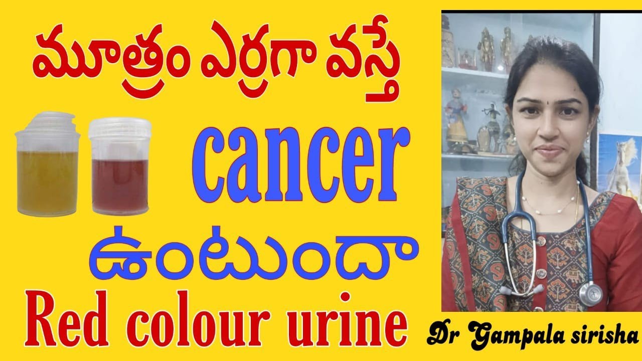 మూత్రం రంగు మారి ఎర్రగా వస్తే cancer ఉంటుందా || Red colour urine || Health tips|| Dr Sirisha gampala