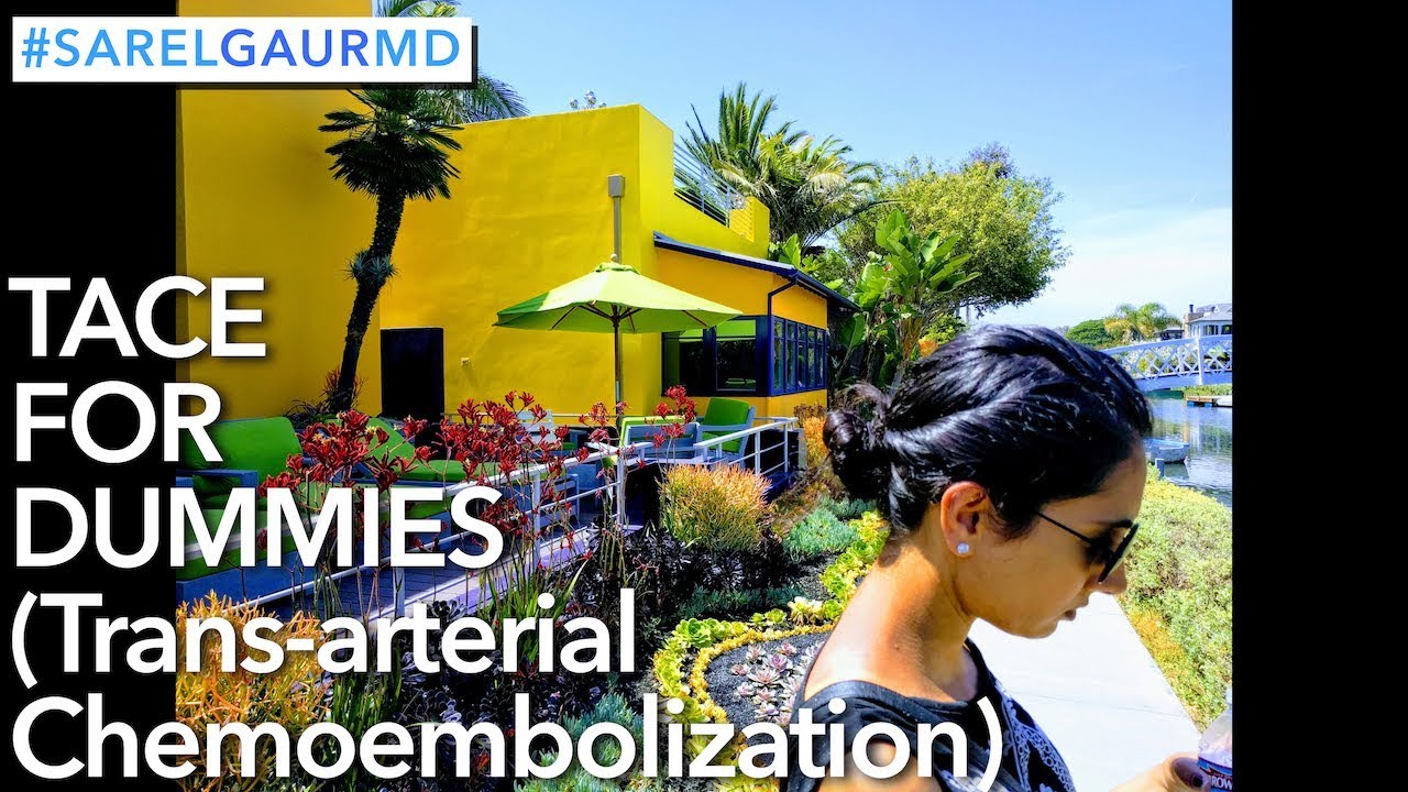 TACE For Dummies (Trans-arterial Chemoembolization)