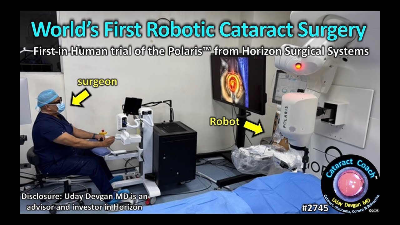 CataractCoach&trade; 2745: Pierwsza na świecie robotyczna operacja zaćmy