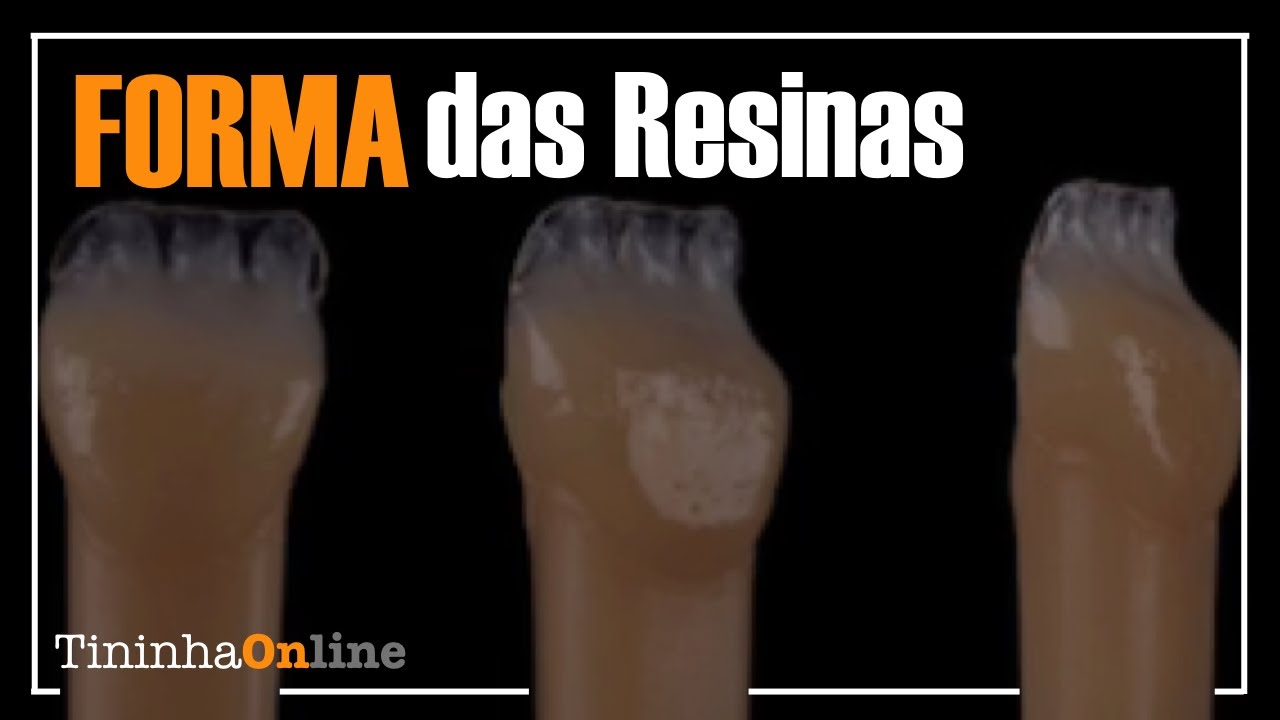 Forma das Restaurações com Resinas