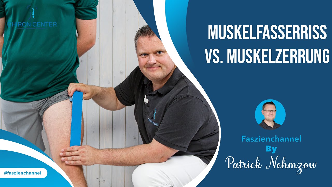 Muskelfasserriss VS. Muskelzerrung – Wie Du es erkennst und unterscheiden kannst