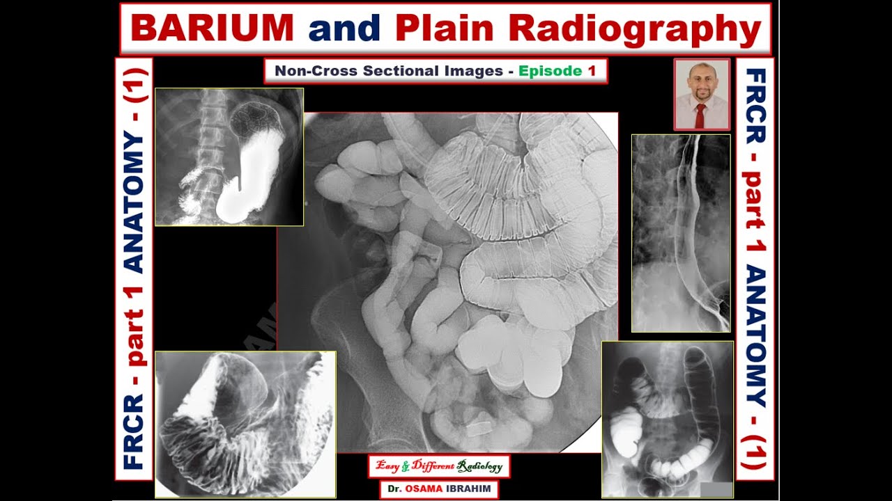 FRCR - part 1 (Anatomy) Episode-1 BARIUM and abdominal radiograph studies.