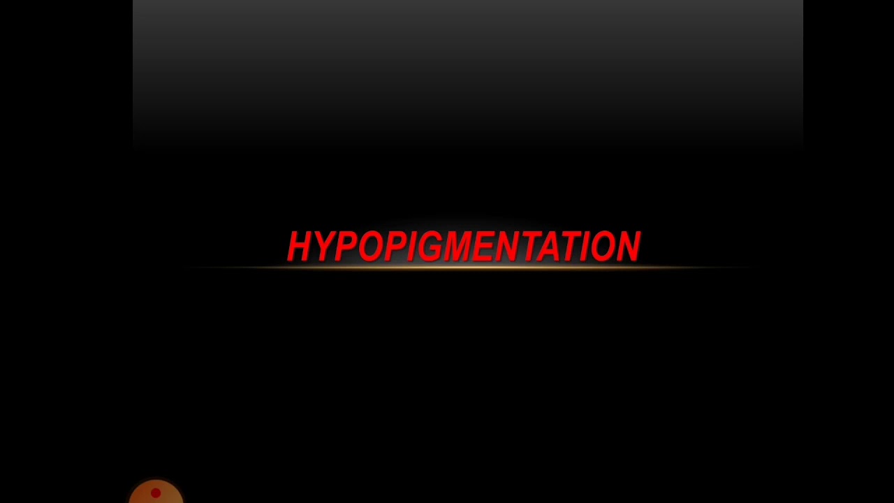 Hypopigmentation seminar by dr Amer al homsi