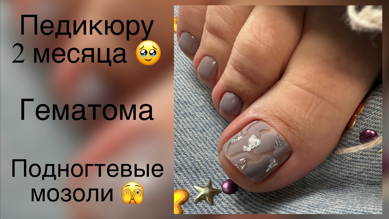 Чистый педикюр. Подногтевые мозоли 🧐 