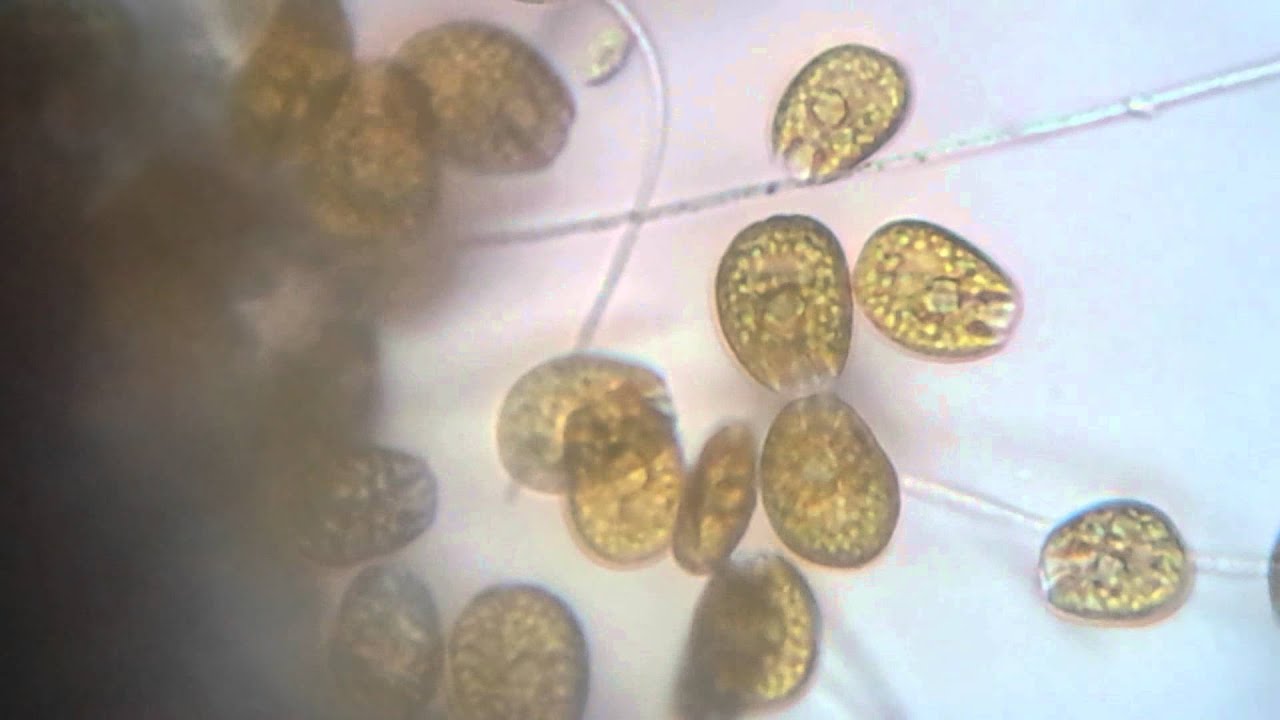 Dinoflagellates Amphidinium 400x