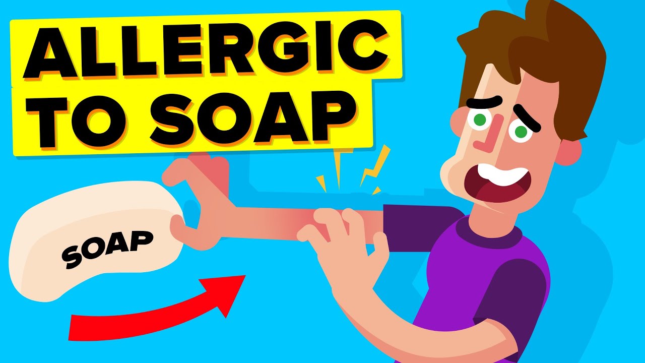 I Am Allergic To Soap (Story)