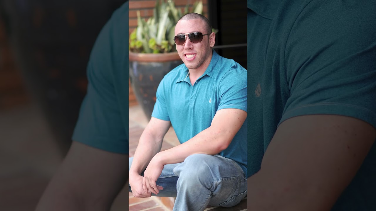Before & After of Gynecomastia Patient after Plastic Surgery in Orange County, Newport Beach, Ca