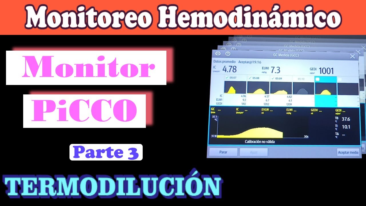 MONITOREO HEMODINÁMICO SISTEMA PICCO - TERMODILUCIÓN (PARTE 3/3)