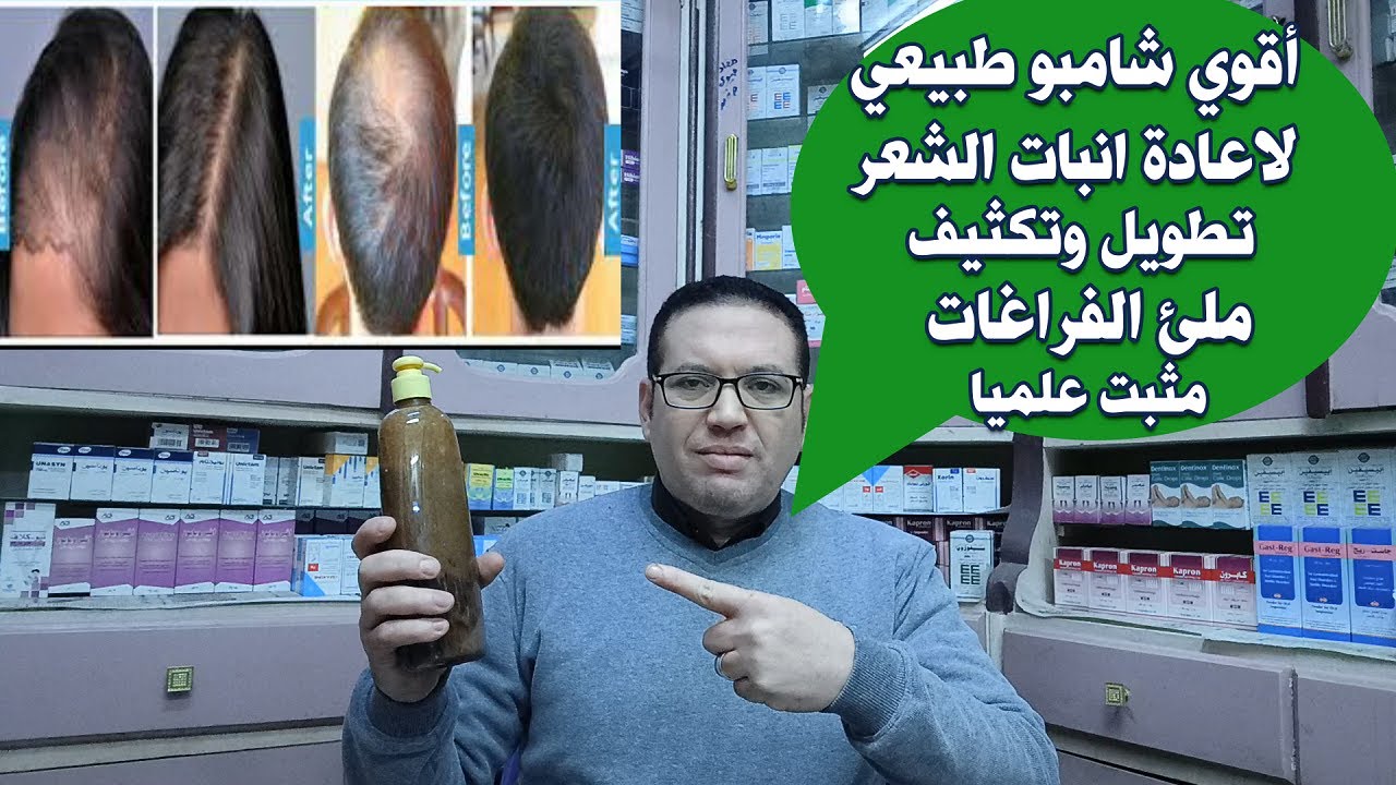 أقوى شامبو طبيعى لانبات الشعر لعلاج الصلع الوراثي وتساقط الشعر العنيف وتطويل وتكثيف وملئ الفراغات