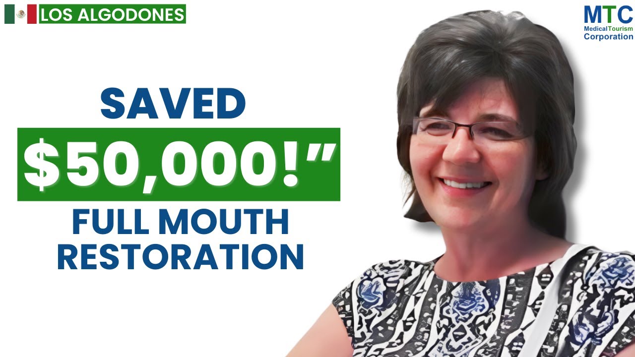 Full Mouth Implants in Los Algodones, Mexico | Client’s Review