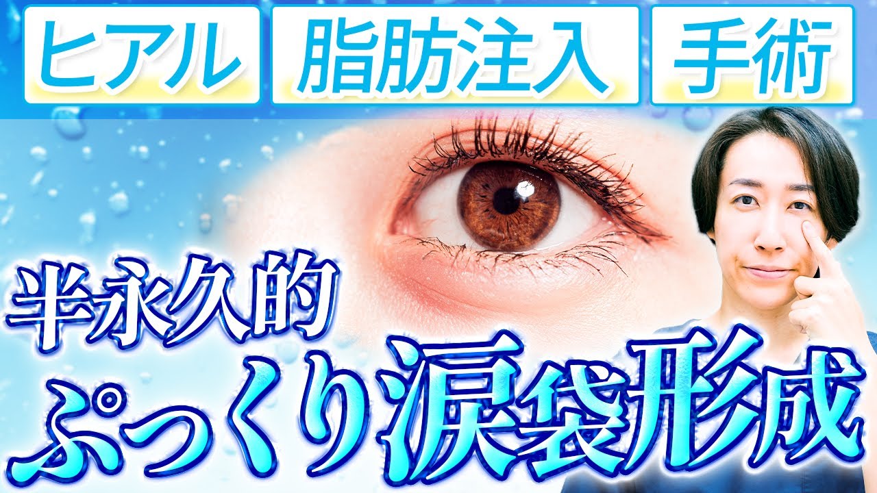 涙袋形成の3つの方法を徹底比較｜ヒアルロン酸・脂肪注入・外科的涙袋形成の違いと向いている人を目元症例5,000件超の美容外科医が一挙解説【涙袋の作り方】