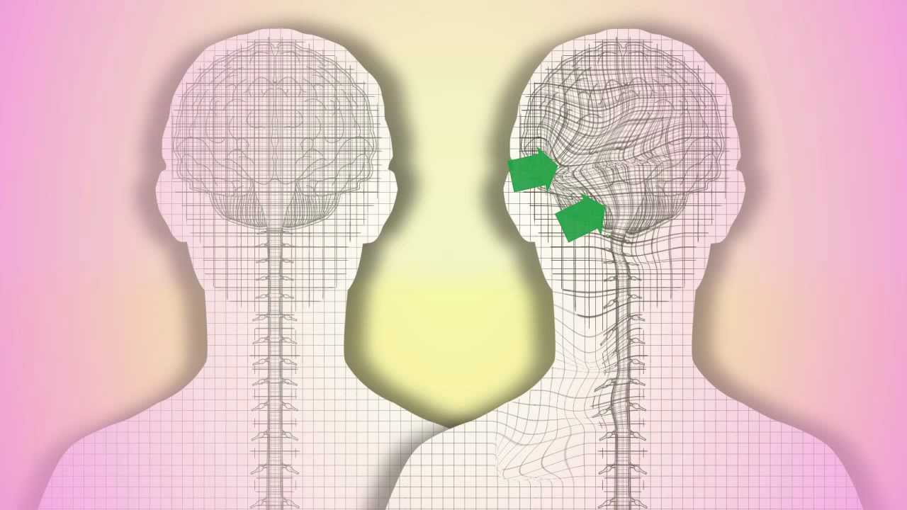 CranioSacral Therapy. What is it? How does it work? by Tad Wanveer
