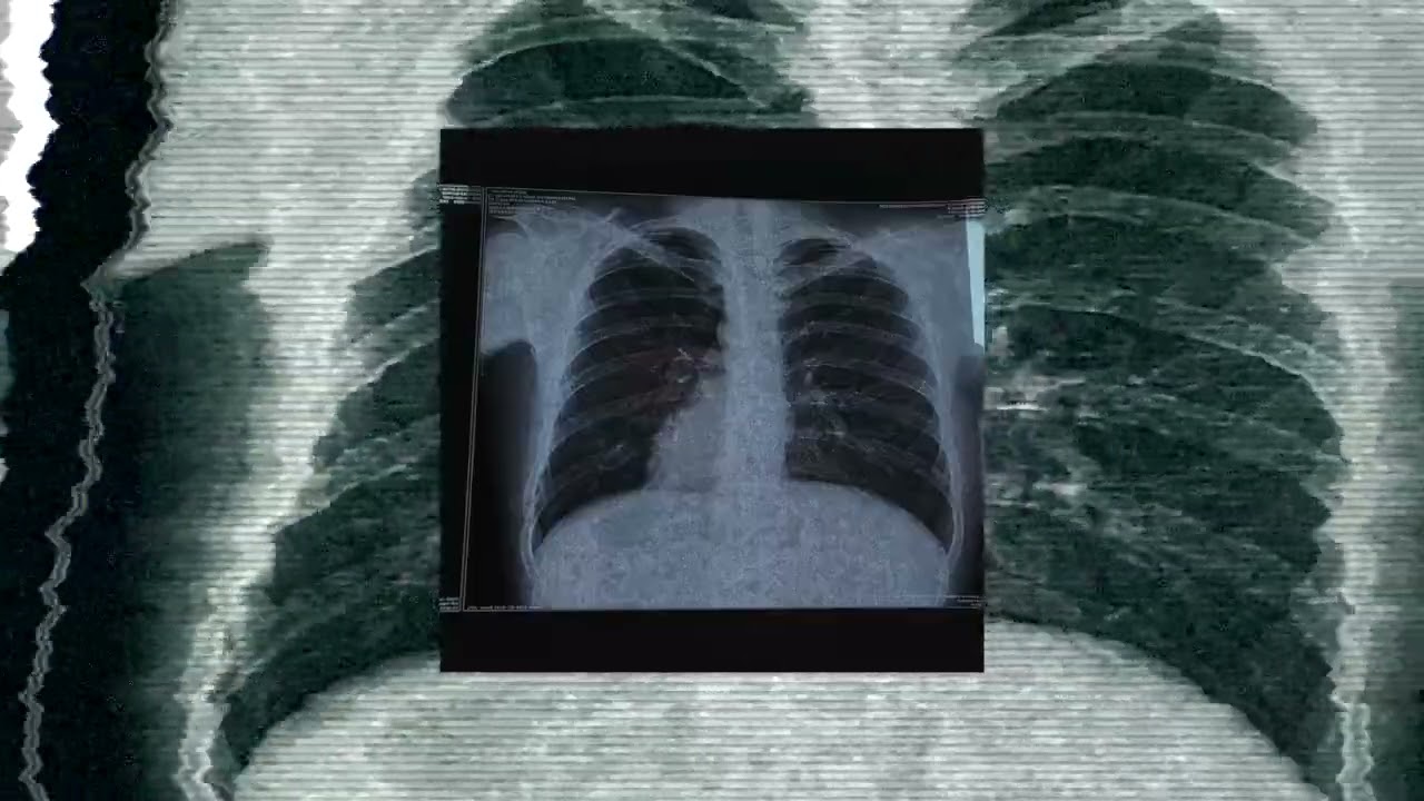 apalim-Dr.Acoola
