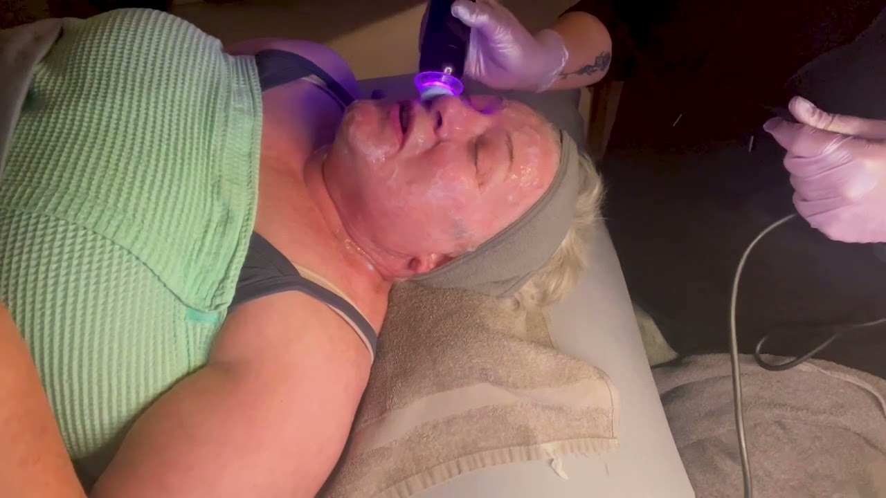 Analisa Hickey in the Aging SkinCategory for TSG2025 - video 3-model 3