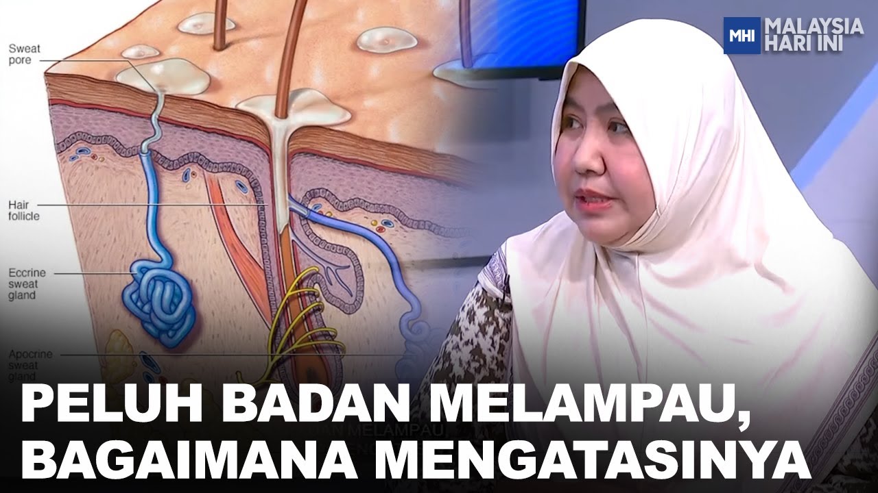 Peluh Badan Melampau, Bagaimana Mengatasinya | MHI (24 Januari 2023)