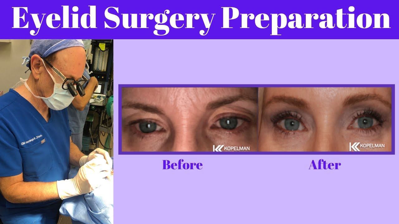 Eyelid Surgery Preparation | Everything You Need To Know