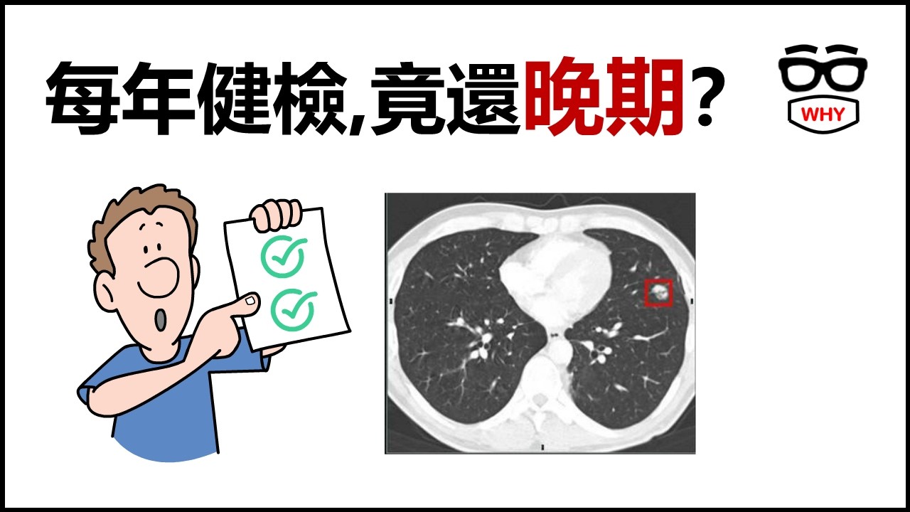 健檢真的能抓出癌症嗎？哪幾種癌症容易被「漏掉」！醫師教你如何精準篩檢