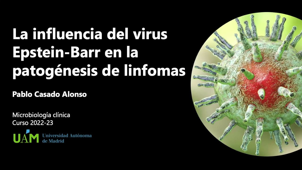 Virus Epstein-Barr y cáncer