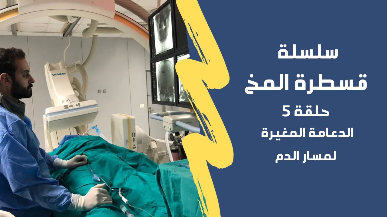 الحلقة ٥ | سلسلة قسطرة المخ : الدعامة المغيرة لمسار الدم لعلاج التمدد الشرياني بالمخ
