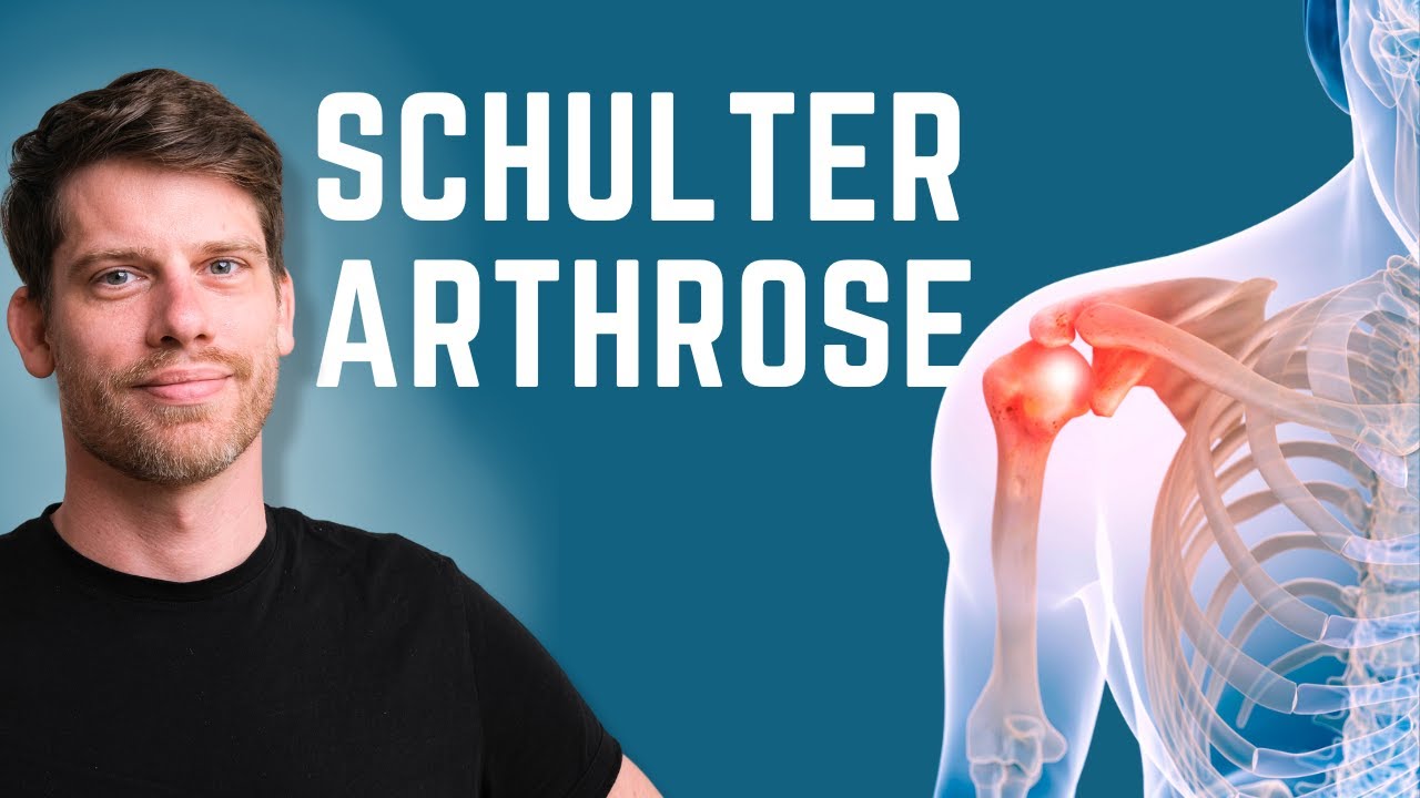 Schulterarthrose ohne OP heilen?